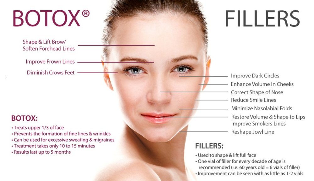 Acne scarring